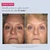 Before-and-after front-facing images showing visibly smoother skin with reduced fine lines and wrinkles, and a more rejuvenated, even-looking complexion after 12 weeks of use.