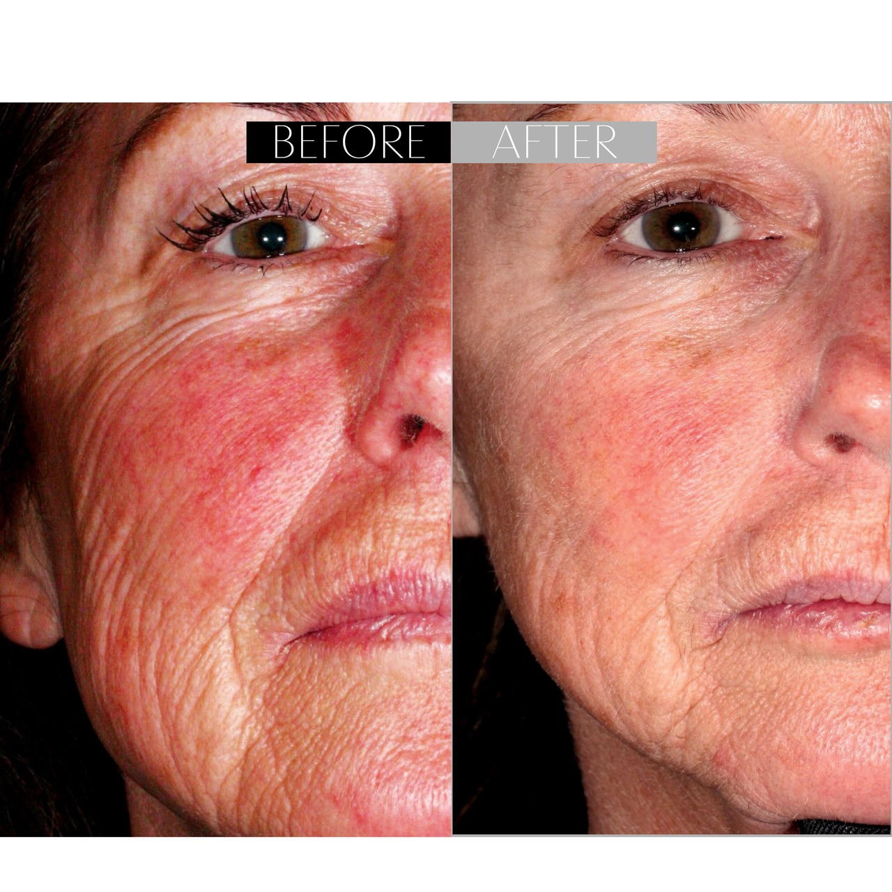 Skin Barrier Repair Cream for Dry, Damaged & Aging Skin | Skinprint