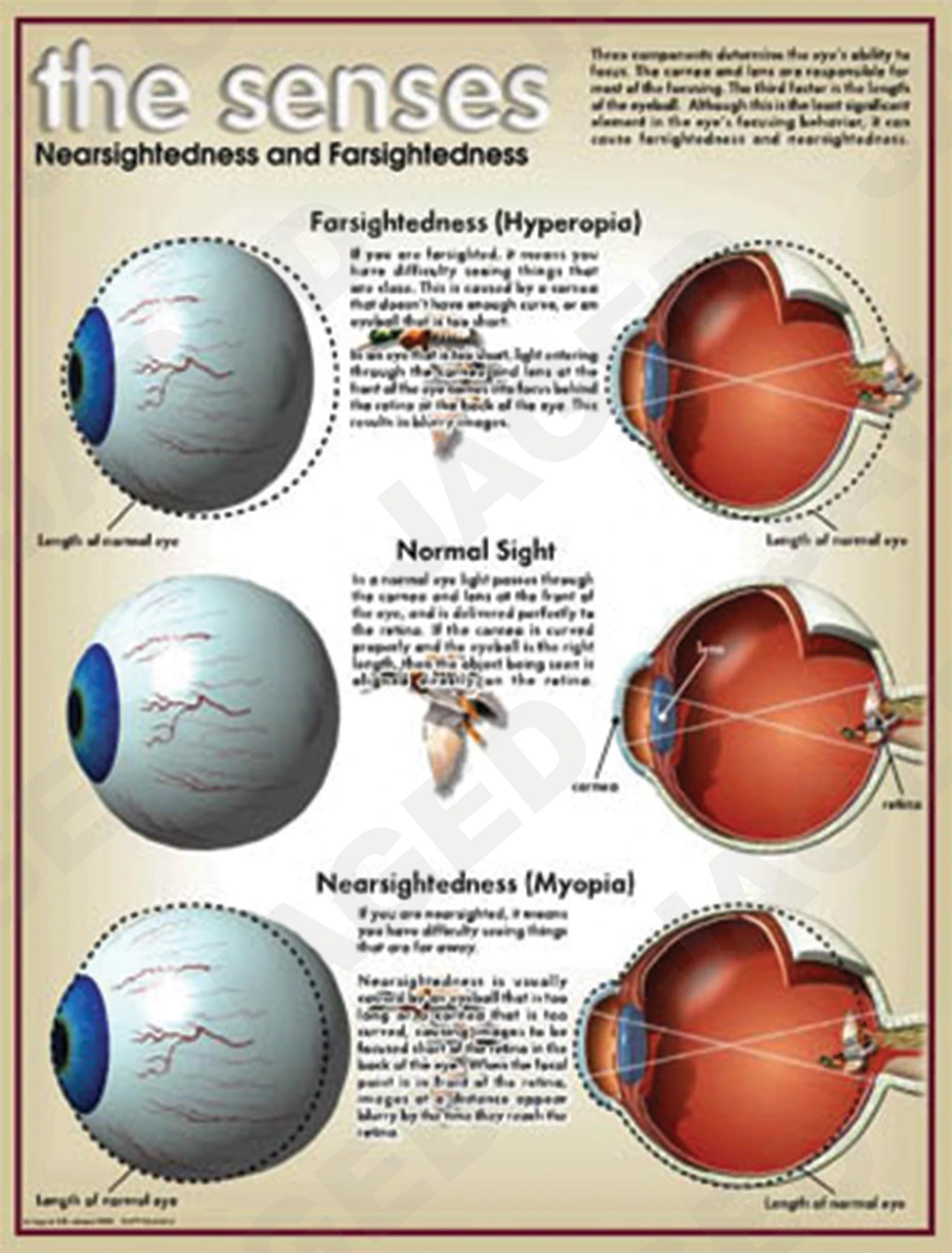 03-PS01-9 Nearsightedness and Farsightedness
