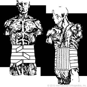 Lumbosacral Support - Rigid Support Item# 170