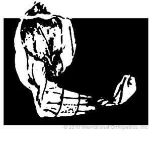 Tennis Elbow Support