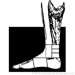 Ankle Wrap - Figure 8