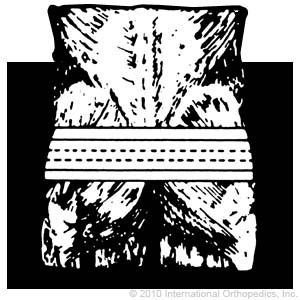 Trochanter Belt - Heavy Duty w/ Removable Lining          Item# 130 130-4 /130-5 / 130-6