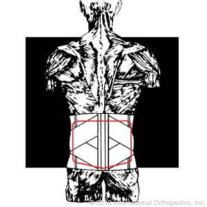 Moldable Lumbosacral Support (185 w/pocket)          Item# 195 195-4 / 195-5 / 195-6