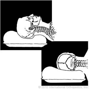 Therapeutic Pillow