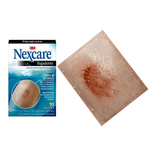 Nexcare Tegaderm Waterproof Transparent Dressing, 10 Count, Assorted Sizes (Package of 10)
