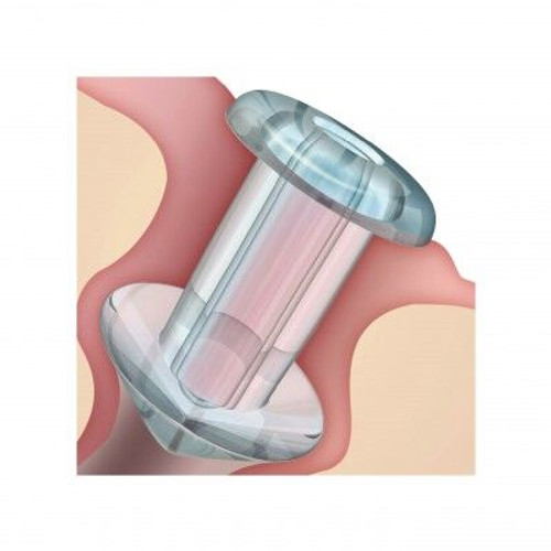 OASIS SOFT PLUG® Flow Control Punctal Plugs - Box of 2 | MH Eye Care Product