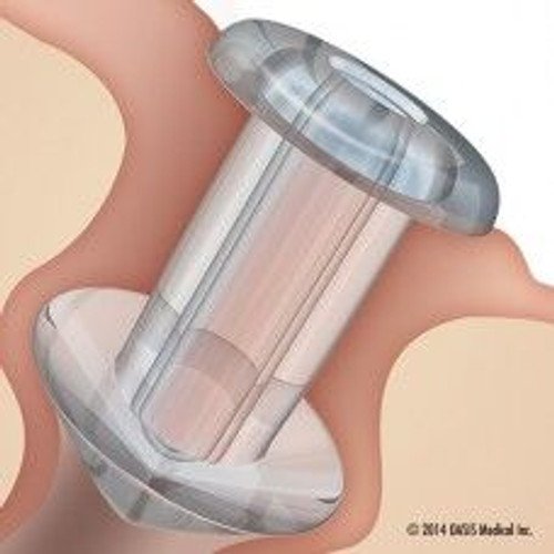 OASIS SOFT PLUG® Silicone Punctal Plugs - Box of 2 | MH Eye Care Product