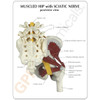 GPI Anatomicals Muscled Hip with Sciatic Nerve Model with Base