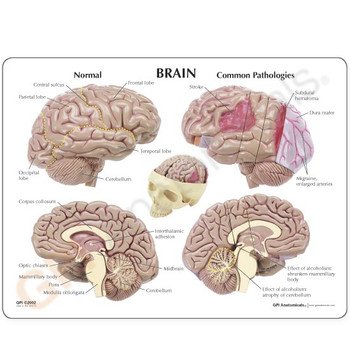 GPI Anatomicals Brain Model without Base