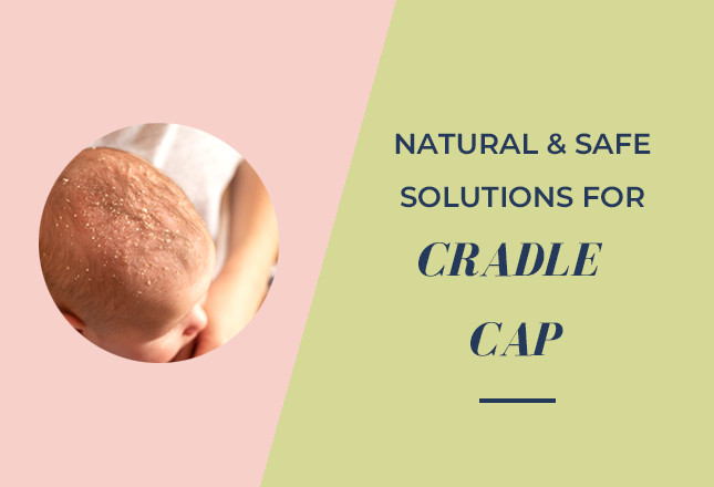 Natural and safe cradle cap solutions for baby