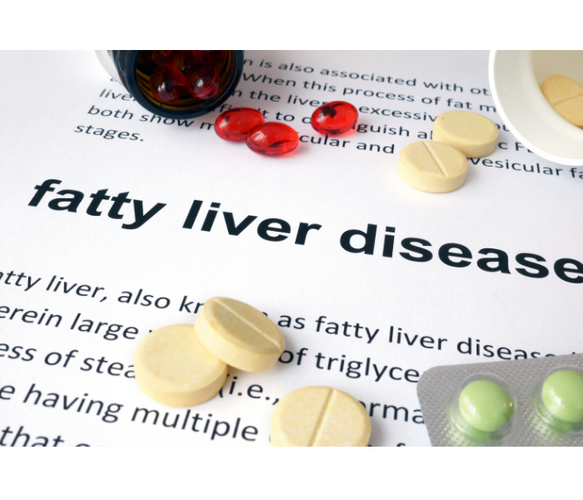 How to Naturally Cleanse Your Liver: Top Herbs, Tips, and Benefits for Optimal Health