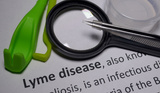 Beyond the Tick Bite: Understanding the Complexities of Lyme Disease