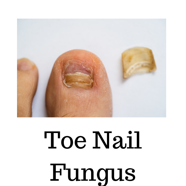 66toe.png