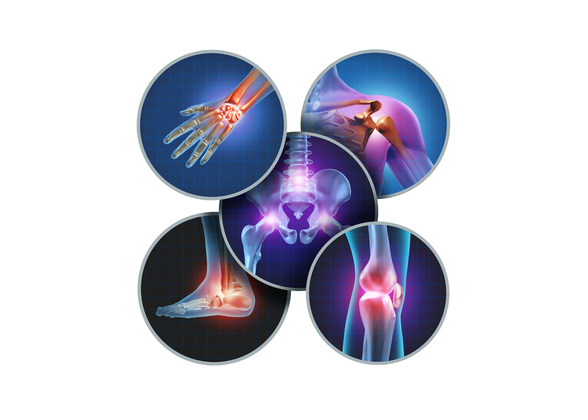 inflammation, joint pain, swelling, how to reduce pain, cream to stop pain, 