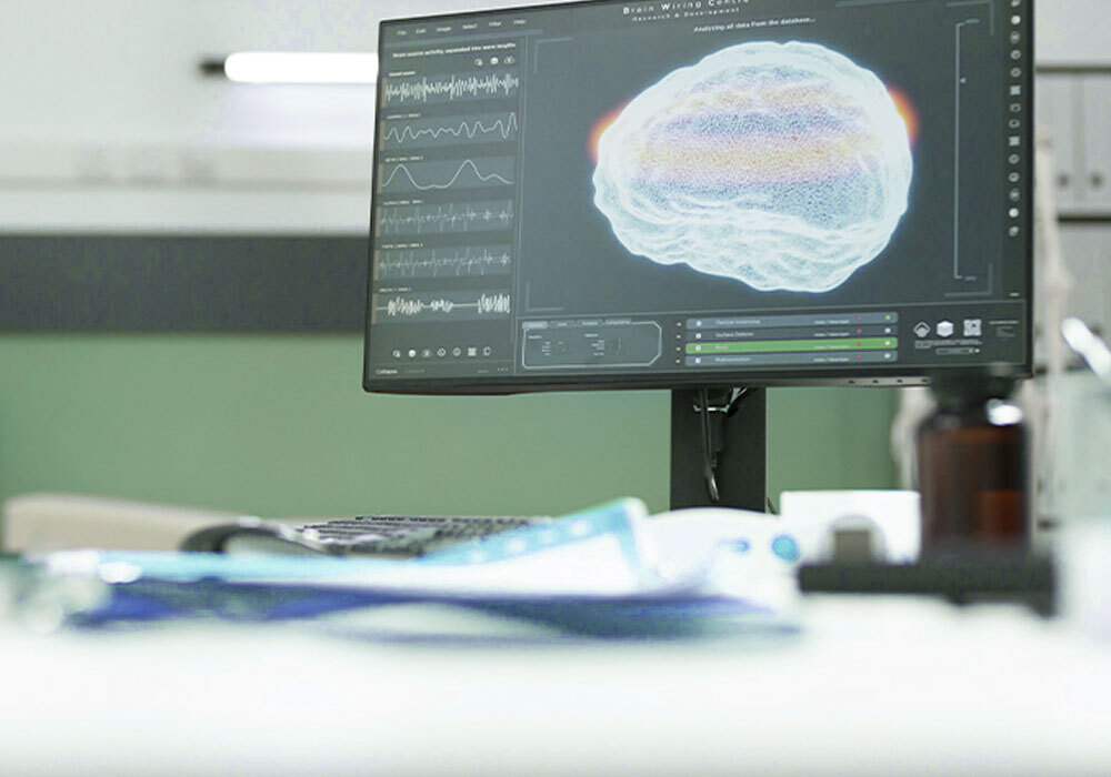 Servicio de activación neurofuncional en Farmacia Can Roca en Terrassa, Barcelona