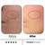 Skin Clear Biome™ before and after