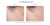 Skin Moisture Lock™ Eyes Before And After