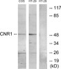 Anti-CNR1 antibody produced in rabbit affinity isolated antibody