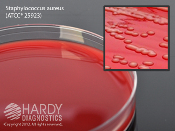 Blood Agar Plate, Sheep Blood in Tryptic Soy Agar (TSA) Base, 100/pk, by Hardy Diagnostics