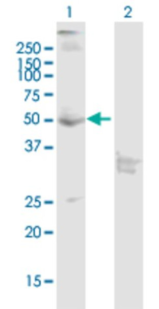 Anti-CNR1 antibody produced in mouse purified immunoglobulin, buffered aqueous solution