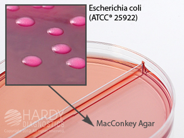 CIN Agar/MacConkey Agar with Sorbitol