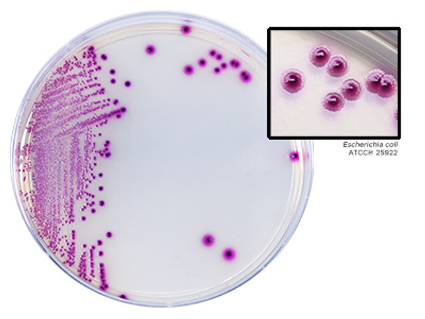 HardyCHROM UTI, a chromogenic medium for all urinary tract pathogens