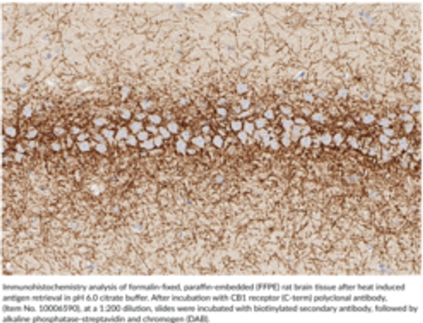 CB1 Receptor (C-Term) Polyclonal Antibody, 1ea, Item No. 10006590