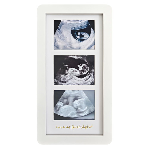 trlry Love at First Sight Triple Ultrasound Frame, 3 Photos, White