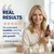 MOERIE Ultimate Hair Growth Serum for Natural Hair Regrowth & Thickening - Anti Thinning & Hair Loss Treatment for Women - Rapid Hair Growth Products - Scalp Oil Alternative - 1.69 fl oz, 2 pack