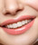 Infracyte LusciousLips Luscious Lips Main Attraction 326 Anti-aging, Moisturizing, Hydrating! Get younger, Sexier and Plumped Lips Instantly!