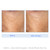 Serious Skincare Retinol Exfoliation Treatment Pads, 60 Count (2Pack)