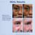 Plexaderm Rapid Reduction Serum - Visibly Reduces Under-Eye Bags & Wrinkles