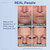 Plexaderm Eye Serum Pump - Visibly Reduces Bags, Wrinkles & Dark Circles