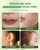 Painless Facial Hair Removal Cream for Women - Sensitive Skin 2-in-1 Kit with Soothing Cream | Upper Lip & Chin Hair Remover | At-Home Depilatory (4 Min, 7 Days Smooth),2.03 Fl Oz