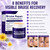Wanban 2Pcs Arnica bruise cream extra strength for Thin Skin, Vitamin K Cream for Bruises & Skin Discoloration, Non-Greasy Formula for Seniors
