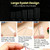 34Pcs Big Eye Steel Sewing Needles Kit - Stainless Steel Portable Hand Sewing Kit with Thread & Needle Threader, Heavy Duty Needle and Thread Tool Set for Beginners, Daily Mending & Embroidery