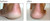 Luxuriant Cracked Heel Repair Twin Pack, The Original, Made in USA, 2.3 oz