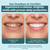 ioRinse AC Anticavity Mouthwash with Fluoride & Molecular Iodine,16.9 fl oz
