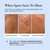EnaSkin Dark Spot Remover for Face & Body with Niacinamide, Corrector Cream