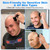 Bpbdzz 6 Pack Replacement Blades for Freebird Head Shaver