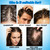 1% Ketoconazole Anti-Dandruff Shampoo for Flaking & Itchy Scalp, 7.78Fl Oz