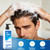 1% Ketoconazole Anti-Dandruff Shampoo for Flaking & Itchy Scalp, 7.78Fl Oz