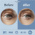 MyHalos Patented Eye Ice Pack for Puffy Eyes Set - Under Eye Masks for Dark Circles and Puffiness- 24 Eye Patches for Wrinkles - Under Eye Ice Pack With Under Eye Patches - Cold Eye Mask for Puffiness