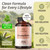 HERBAMAMA Stinging Nettle Root Capsules - Urinary Tract Support