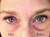 Instant Eye Bag Puffiness And Wrinkle Remover Cream For Women And Men Made In The USA! Cruelty-Free Larger Size