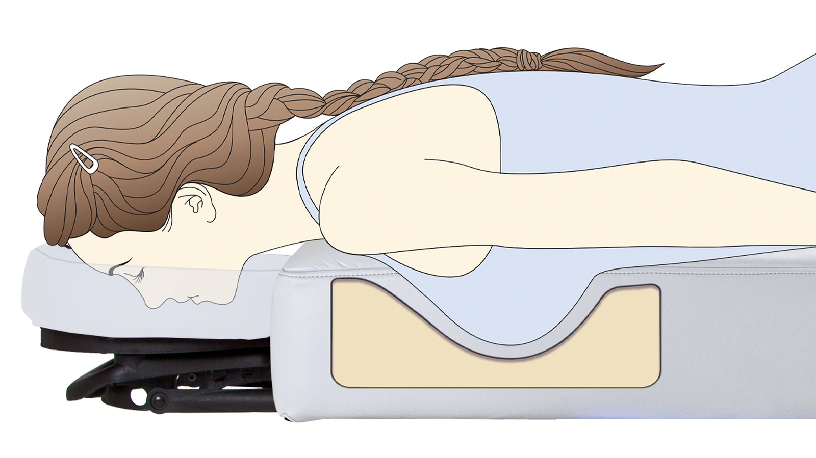 Conforma Lux Breast Recess System Diagram