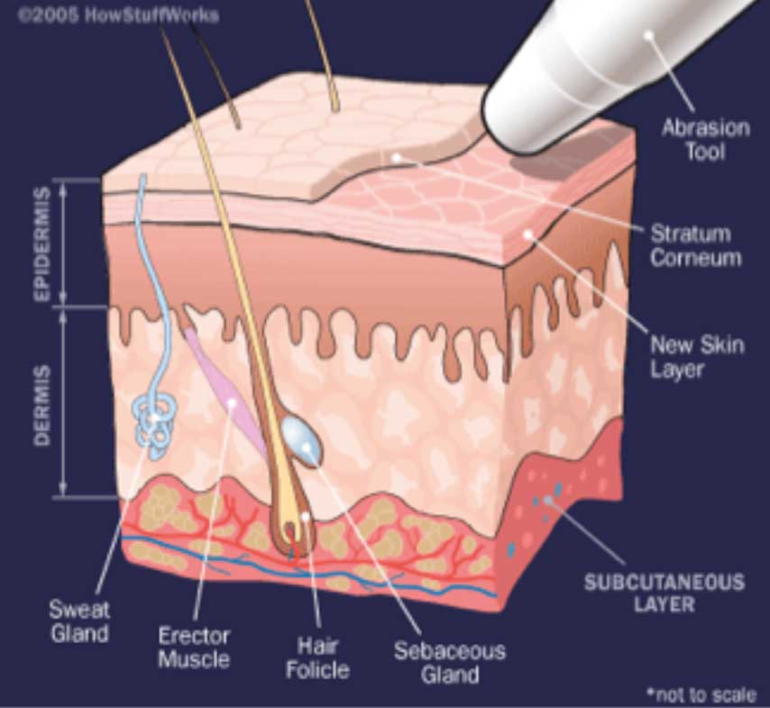 the-science-and-art-of-microdermabrasion.jpg