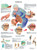 3B Scientific Anatomical Chart - arthritis, paper