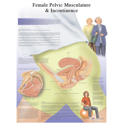 3B Scientific Anatomical Chart - female urinary incontinence chart, laminated